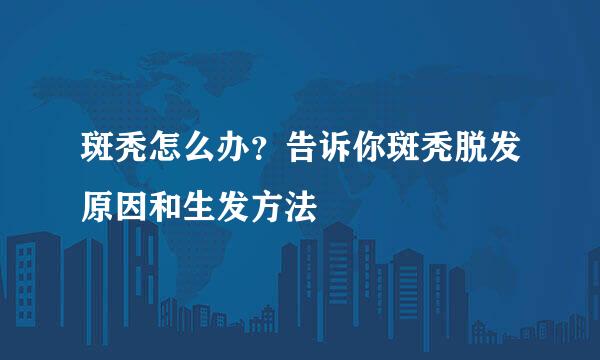 斑秃怎么办？告诉你斑秃脱发原因和生发方法