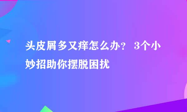 头皮屑多又痒怎么办？ 3个小妙招助你摆脱困扰