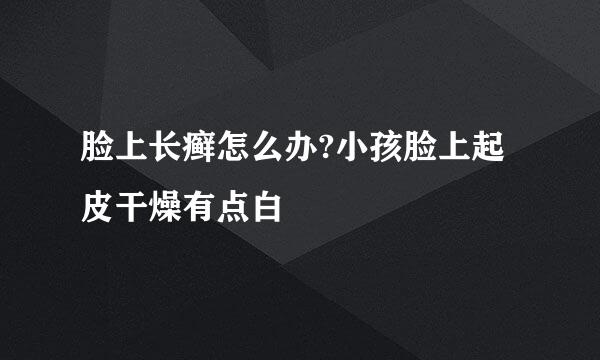 脸上长癣怎么办?小孩脸上起皮干燥有点白