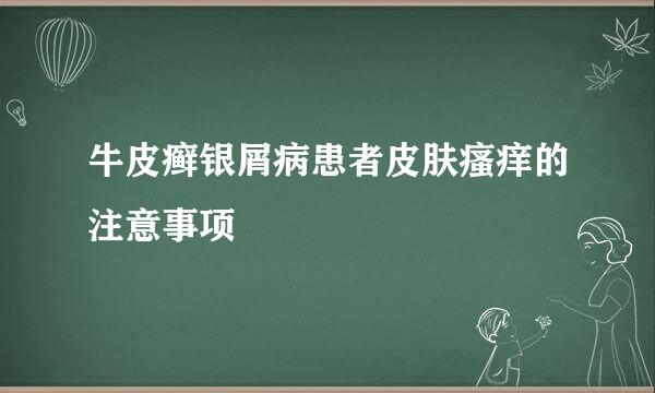 牛皮癣银屑病患者皮肤瘙痒的注意事项