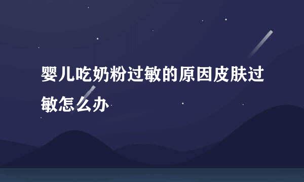 婴儿吃奶粉过敏的原因皮肤过敏怎么办