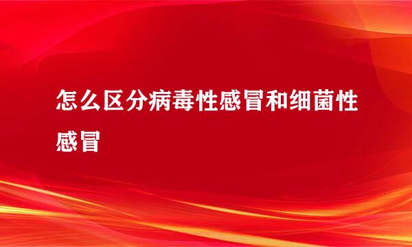 怎么区分病毒性感冒和细菌性感冒
