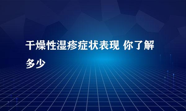 干燥性湿疹症状表现 你了解多少
