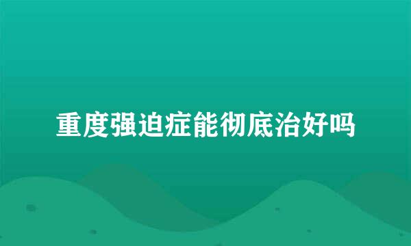 重度强迫症能彻底治好吗