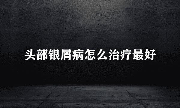 头部银屑病怎么治疗最好
