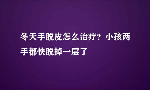 冬天手脱皮怎么治疗？小孩两手都快脱掉一层了