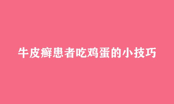 牛皮癣患者吃鸡蛋的小技巧