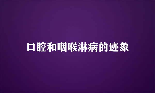 口腔和咽喉淋病的迹象