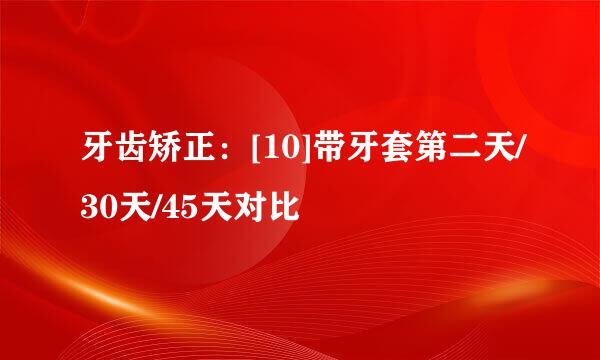 牙齿矫正：[10]带牙套第二天/30天/45天对比